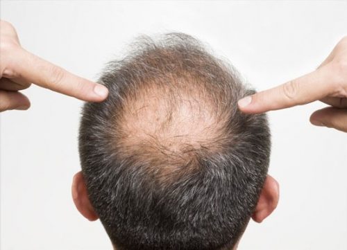 Shampoo SEBRYL ¿Es bueno? Las opiniones dicen mucho.... 68