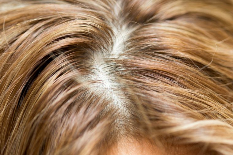 Aceite de Ricino en el cabello 1